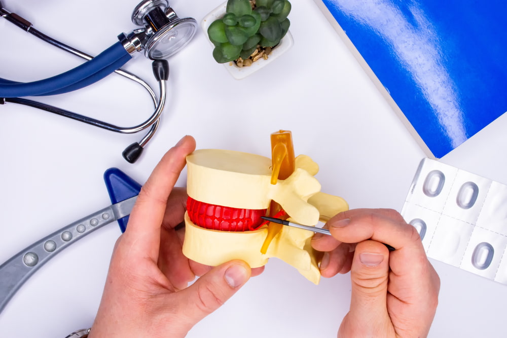 Prótese discal cervical: quando ela é indicada?
