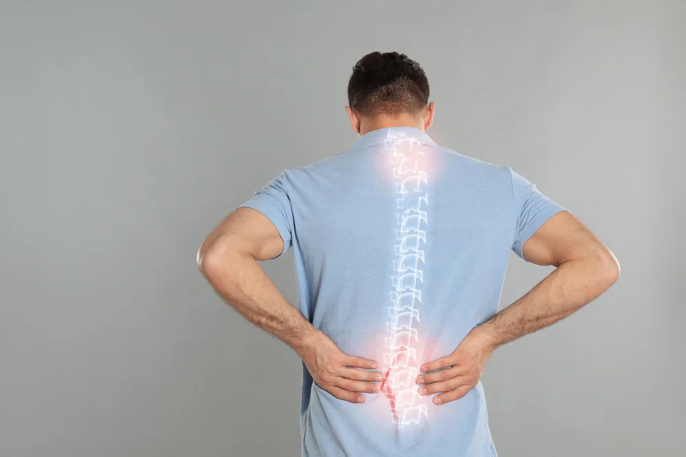 O que é a fratura de compressão vertebral?